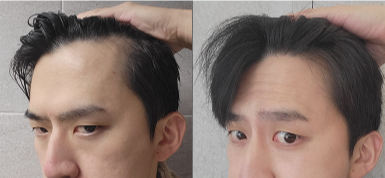 Tricoex Scalp Ampoule